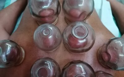 Coppettazione