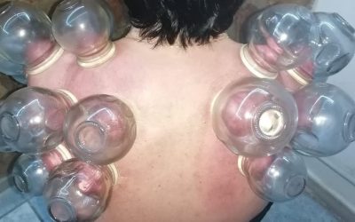 Coppettazione Spalle